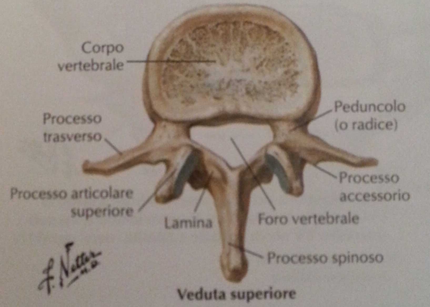 ernia discale